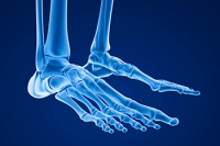 Understanding,Stress Fractures of the Foot