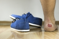 Relieving Blister Pain