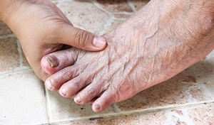 Symptoms of Toenail Fungus
