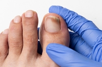 What Is Causing My Toenail Problems?