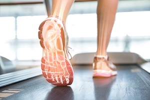 What Pain in the Bottom of the Foot Indicates