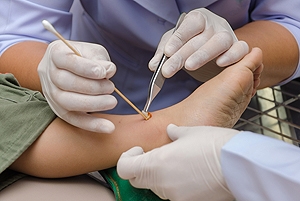 Different Types of Foot Wounds