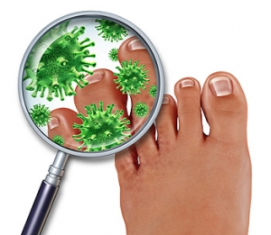 Preventing Athlete&#039;s Foot