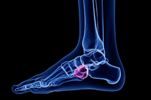 Where is the Cuboid Bone Located?