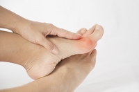 Surgery for Bunions