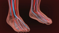 Causes of Poor Circulation in Lower Limbs