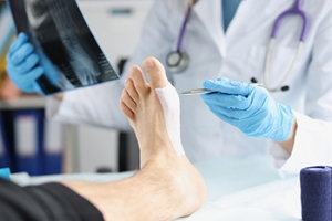 Minor Foot Surgery