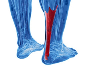 Achilles Tendon and Overuse