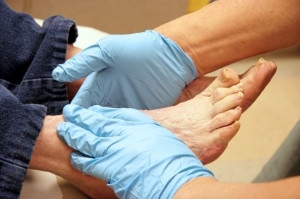 Diabetes and Foot Care